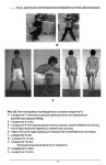 И.Ф.Ахтямов, О.А.Соколовский - Хирургическое лечение дисплазии тазобедренного сустава (2008)