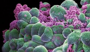 Раковые клетки не бессмертны
