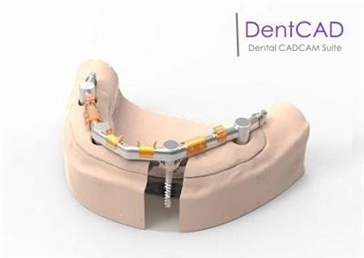 Delcam DentCAD 2015 R1 180201